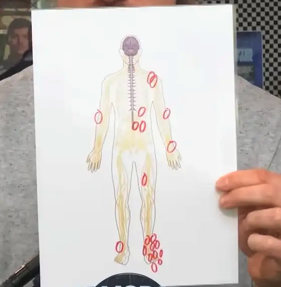 Peter Forsberg : 22 opérations et un corps marqué à jamais