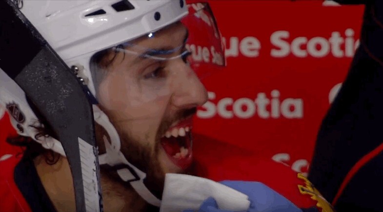 Du travail pour le dentiste de Vincent Trocheck