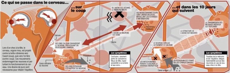 Tout connaître des commotions cérébrales