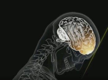 Pourquoi le casque ne protège pas des commotions