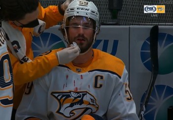 Roman Josi en sang après un boarding non sifflé