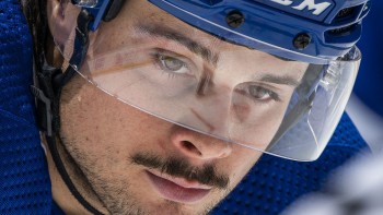 Auston Matthews a du se faire opérer