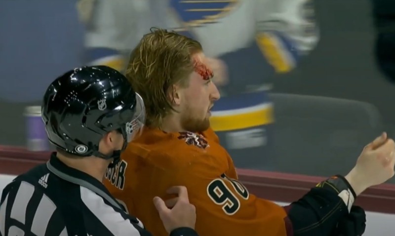 Janis Moser en sang après son combat face à Josh Leivo