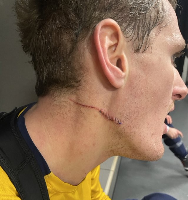 Michael McCarron a vu le patin de Lian Bischel de très près